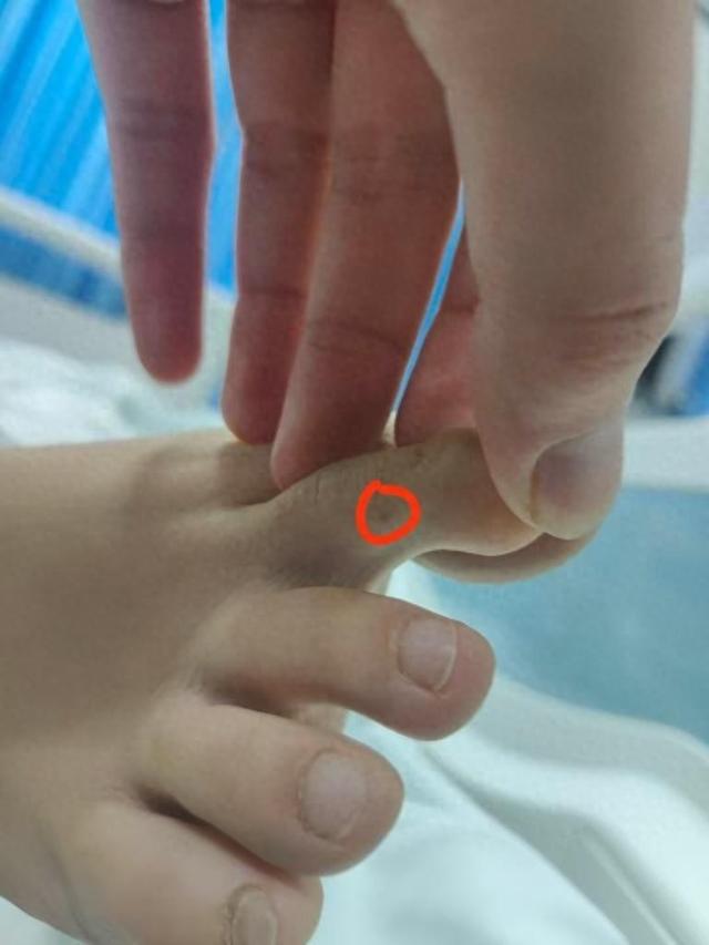 播回应质疑：没提任何索赔只希望调查清楚C
